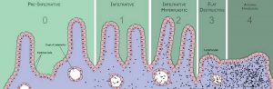 Cómo saber si soy celiaco